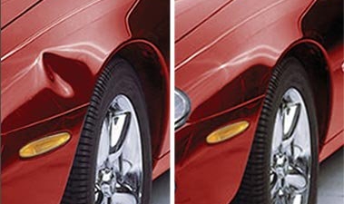 Boyasız Göçük Düzeltme.